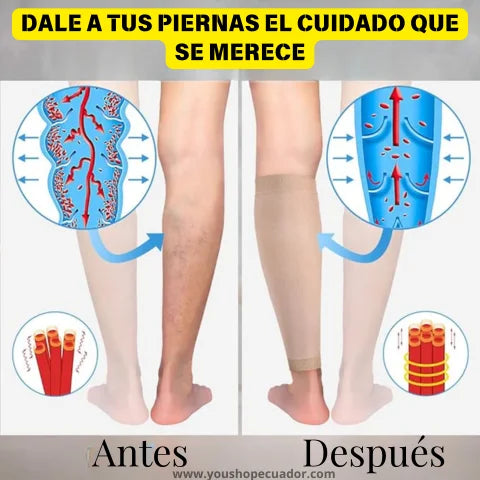 MEDIAS CONFORT LEGS™ Despídete del cansancio y la hinchazón + PROMO 2X1 🎁