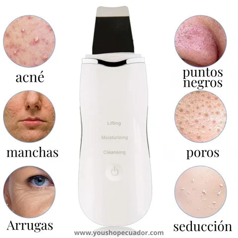 SKINFINITY® LIMPIADOR FACIAL ULTRASÓNICO para una limpieza profunda y piel radiante